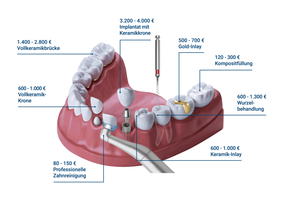 Kosten beim Zahnarzt