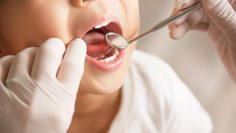 Zahnzusatzversicherung für Kinder