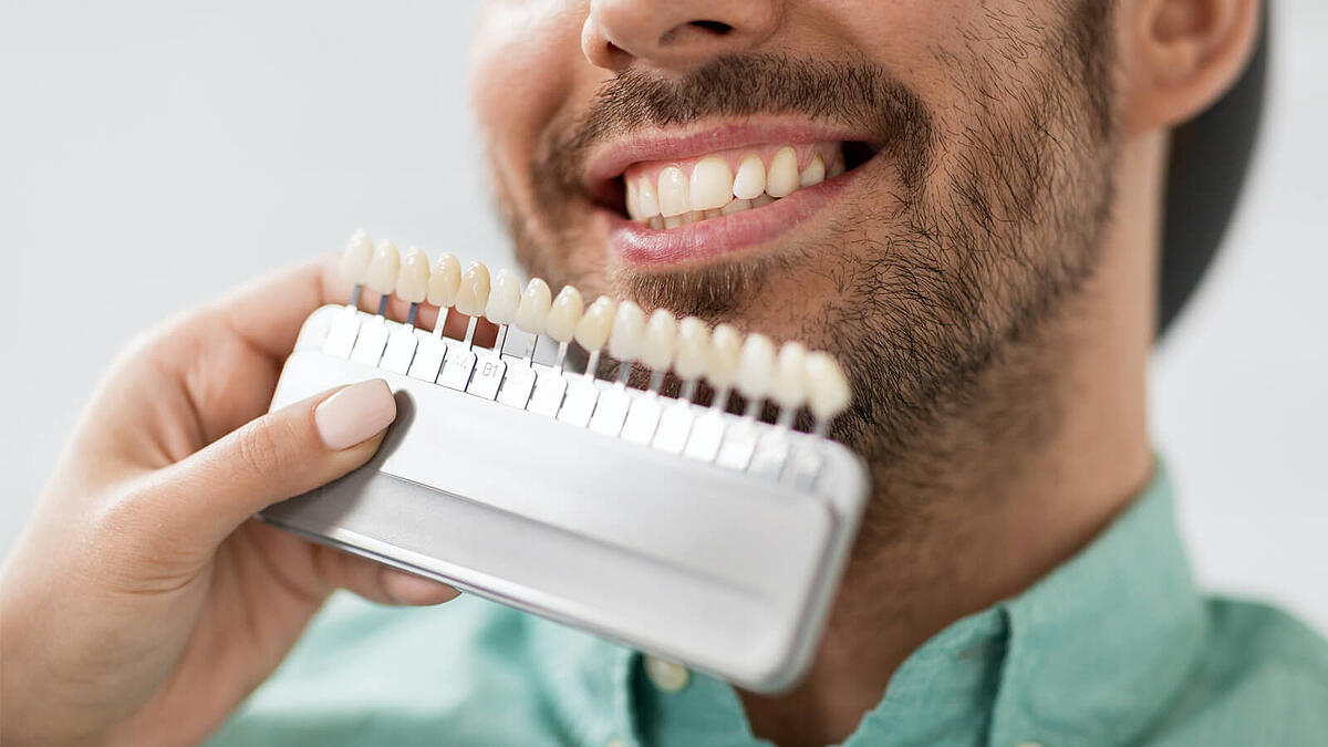Wie viel Kosten 20 Veneers?