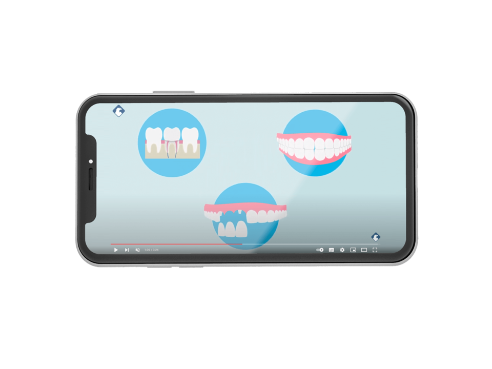 DFV Visual
