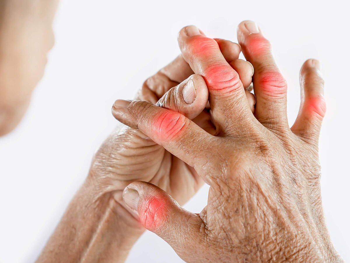 Gicht: Ursachen, Symptome, Behandlung