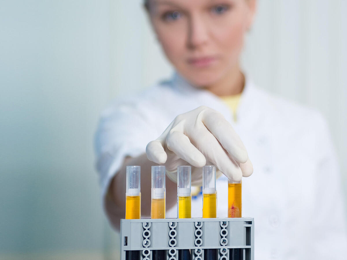 Harnsäure im blut ursache