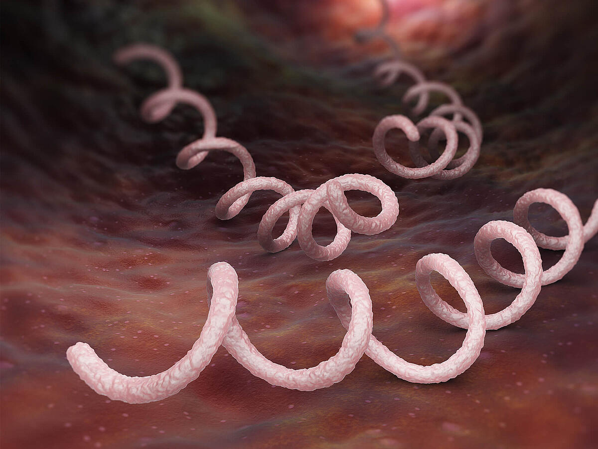 Syphilis Ursachen, Symptome, Therapie