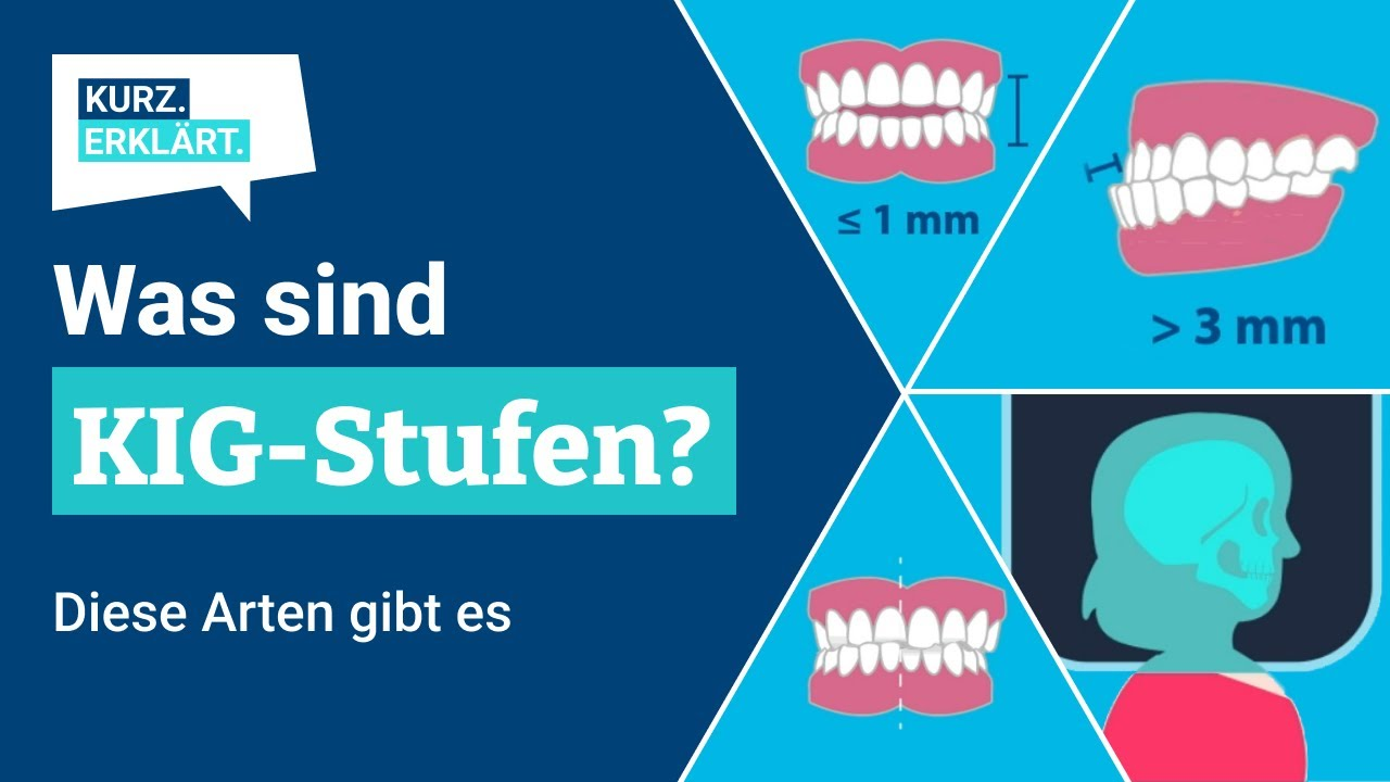 KIG-Stufen: Was bedeuten die kieferorthopädischen Indikationsgruppen?