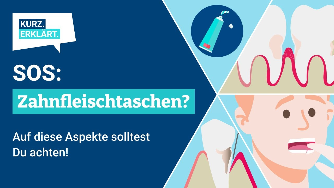 SOS: Zahnfleischtaschen! Was sollte ich jetzt wissen und was ist zu tun?