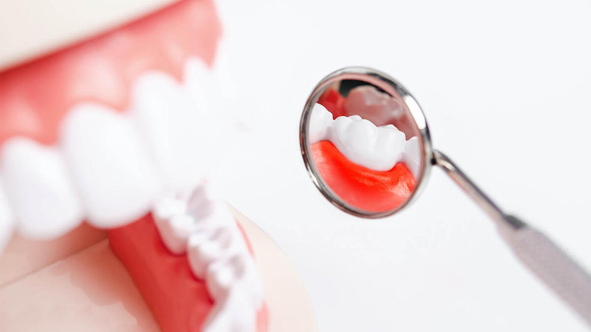 Zahnfleischrückgang: Ursachen, Symptome, Behandlung
