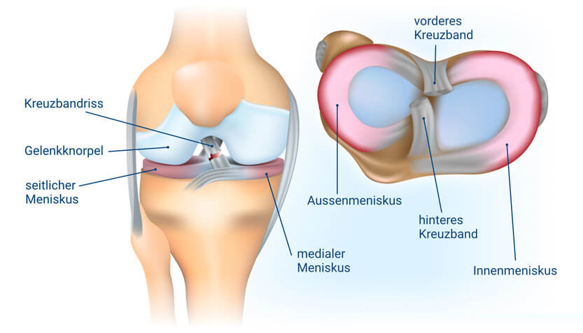 Weg ursache knickt knie Bewegungsstörungen der