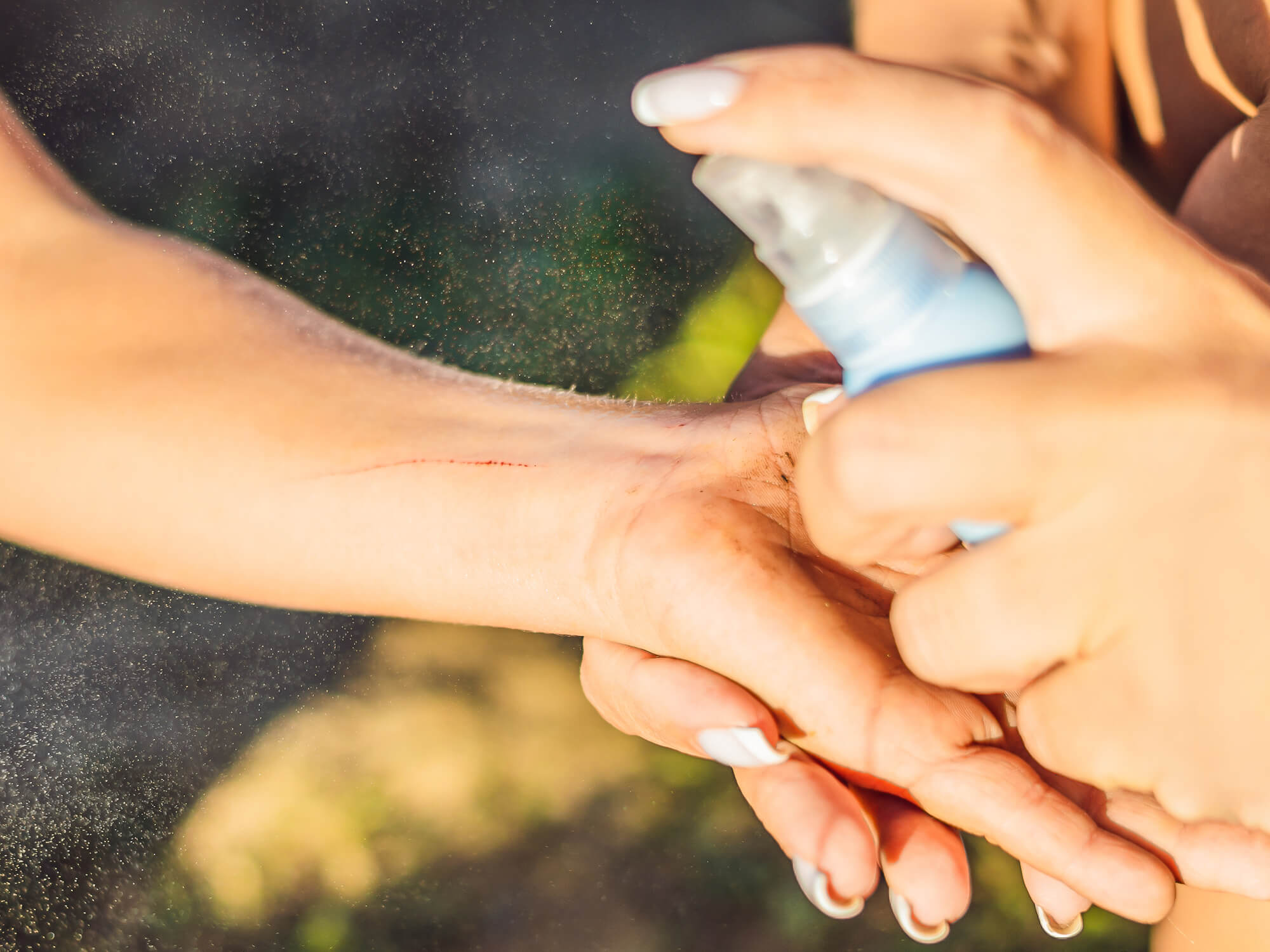 Mucken Plage Wie Sie Sich Jetzt Optimal Schutzen Konnen