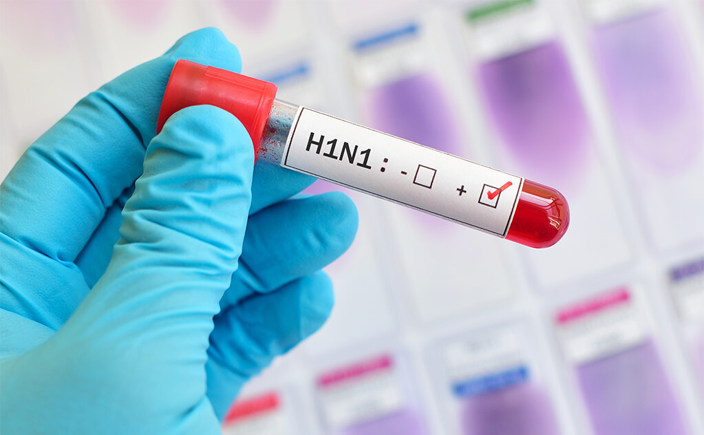 H1n1 Schweinegrippe