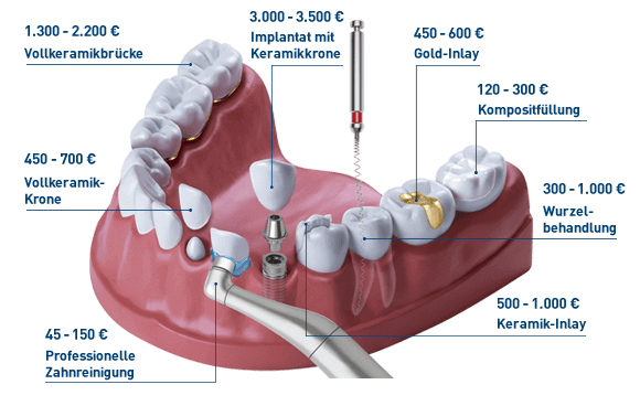 Zahnarztkosten